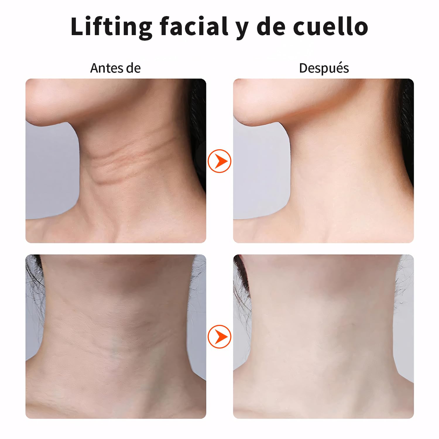 Dispositivo de Estiramiento Facial de microcorriente